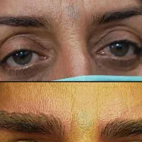 تخفیف میکرو فقط تا فردا