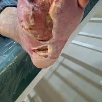 خدمات کلینیک تخصصی زخم و دیابت|خدمات آرایشگری و زیبایی|شهریار, شهریار|دیوار