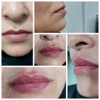 مطب زیبایی آیسان