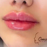 تخفیفات کلینیک زیبایی