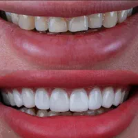 مرکز تخصصی کامپوزیت در شیراز مطب دندانپزشکی|خدمات آرایشگری و زیبایی|شیراز, ملاصدرا|دیوار