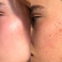 آرایشی ،درمانی