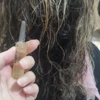 ویال تراپی ساقه مو وکف سر برای رشد واسیب