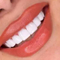 دندانپزشکی ، ایمپلنت، روکش، کامپوزیت ، عصب کشی|خدمات آرایشگری و زیبایی|کوهدشت, |دیوار