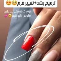 کاشت ناخن در استانه اشرفیه و شعبه لولمان