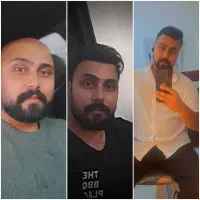 کاشت مو