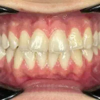 دستیار دندانپزشکی