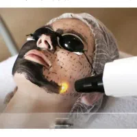 کربن لیزر برطرف کردن لک روشن سازی ۵۰۰تا شات ۳۹۰