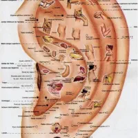 لاغری تضمینی با ای اس پی|آرایشی، بهداشتی، درمانی|کرمان, |دیوار