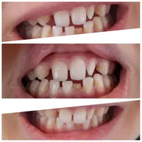 خدمات دندانپزشکی|خدمات آرایشگری و زیبایی|قم, عمار یاسر|دیوار