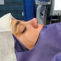 عمل بینی های استخوانی وگوشتی فقط 50 میلیون