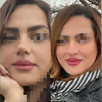 جشنواه ویژه  خدمات   عمل بینی لیپو ساکشن