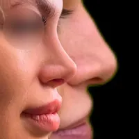 عمل جراحی بینی توسط متخصص زیباییent/ترمیم بینی|خدمات آرایشگری و زیبایی|کرج, چهارصد دستگاه|دیوار