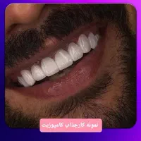 دندان سازی ویتا خدمات و ساخت دندان