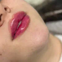 تخفیف ویژه بوتاکس،فیلر،مزو،لیزر موهای زائد کندلا|خدمات آرایشگری و زیبایی|کرج, فاز ۲ مهرشهر|دیوار