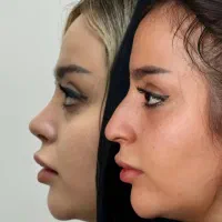 عمل بینی در تهران/پذیرش مراجعین شوشتر/جشنواره ویژه