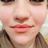 تزریق ژل و بوتاکس|خدمات آرایشگری و زیبایی|بندر کنگان, |دیوار