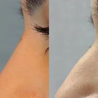 خدمات زیبایی کلینیک فارا دامغان|خدمات آرایشگری و زیبایی|دامغان, |دیوار