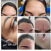 مدل برای تزریق فیلر،بوتاکس،مزو،آنزیم تحت نظر پزشک|خدمات آرایشگری و زیبایی|مشهد, آزادشهر|دیوار