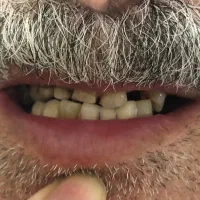 ساخت پروتز مصنوعی|پزشکی|آمل, |دیوار