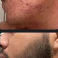 ترز تهیه کرم های اصل و روغن گیاهی رویش مجدد|آرایشی، بهداشتی، درمانی|تهران, اسکندری|دیوار