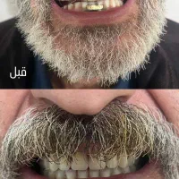 دندانسازی محلات|خدمات آرایشگری و زیبایی|محلات, |دیوار