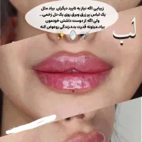 تزریق ژلوبوتاکس تخصصی در پرندبا نازلترین قیمت