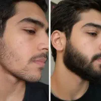 پسر بی ریش کنسله