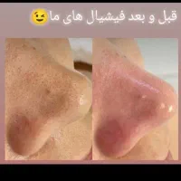 فیشیال تخصص و پدیکور و جوان سازی دست|خدمات آرایشگری و زیبایی|سرپل ذهاب, |دیوار
