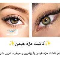 کاشت مژه هیدن ۲۰۰              پاکسازی وفشیال۶۰۰