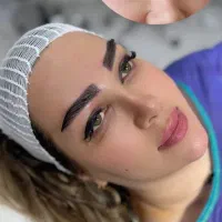مرکز فوق تخصصی( کاشت مو ۱۴ م/کاشت ابرو ۱۰م)