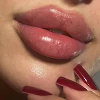 کلینیک پوست و زیبایی   ژل لب/فیلرگونه/زاویه/بوتاکس|خدمات آرایشگری و زیبایی|قم, صفائیه|دیوار