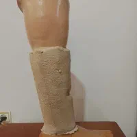 پروتز پای چپ