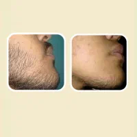 بلیت.کنسرت تغییر