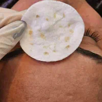 فیشال تخصصی و درمانی صورت|خدمات آرایشگری و زیبایی|شیراز, شهرک والفجر|دیوار