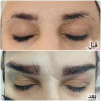 کاشت ابرو طبیعی با ظرافت و تراکم بالا