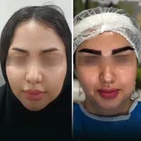کلینیک VIP و تخصصی پوست، مو و زیبایی پارسامهر|خدمات آرایشگری و زیبایی|یاسوج, |دیوار