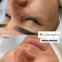 فشیال تخصصی پوست در مطب پزشک