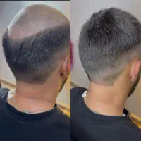 انواع پروتز مو فقط اورجینال وارداتی(نقد و اقساط)|آرایشی، بهداشتی، درمانی|تهران, فردوس|دیوار