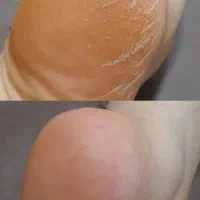 پدیکور درمانی