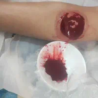 طب سوزنی،زالو درمانی،حجامت|خدمات آرایشگری و زیبایی|تربت جام, شهید نصرالهی|دیوار