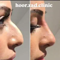 جشنواره پاییزه و افتتاح کلینیک بوتاکس وفیلر|خدمات آرایشگری و زیبایی|ارومیه, |دیوار