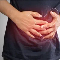 رفلاکش معده