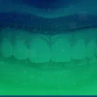 حقیقت ایمپلنت دندان، کلینیک یودنتال