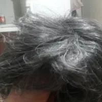 کلاه گیس مردانه|آرایشی، بهداشتی، درمانی|نظرآباد, شهرک صنعتی سپهر|دیوار