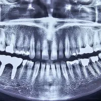استخدام منشی و دستیار دندانپزشکی