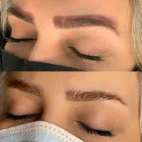 مرکز تخصصی ریموو صورت(پاک کردن تتو صورت)