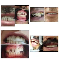 اورژانس دندانپزشکی در منزل شما شبانه‌روزی|خدمات آرایشگری و زیبایی|کرج, فاز ۱ مهرشهر|دیوار