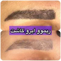 ریموو خط چشم و ابرو