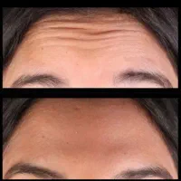 فرصت استثنایی زیبایی و لاغری، تخفیف به مدت محدود|خدمات آرایشگری و زیبایی|اهواز, کیانپارس |دیوار